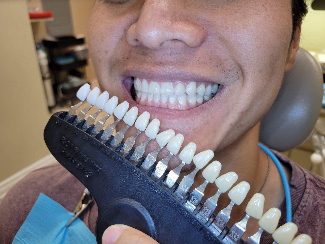 smile background https://ottawadentalcare.ca/wp-content/uploads/2025/10/smile-background-1280x960.jpg