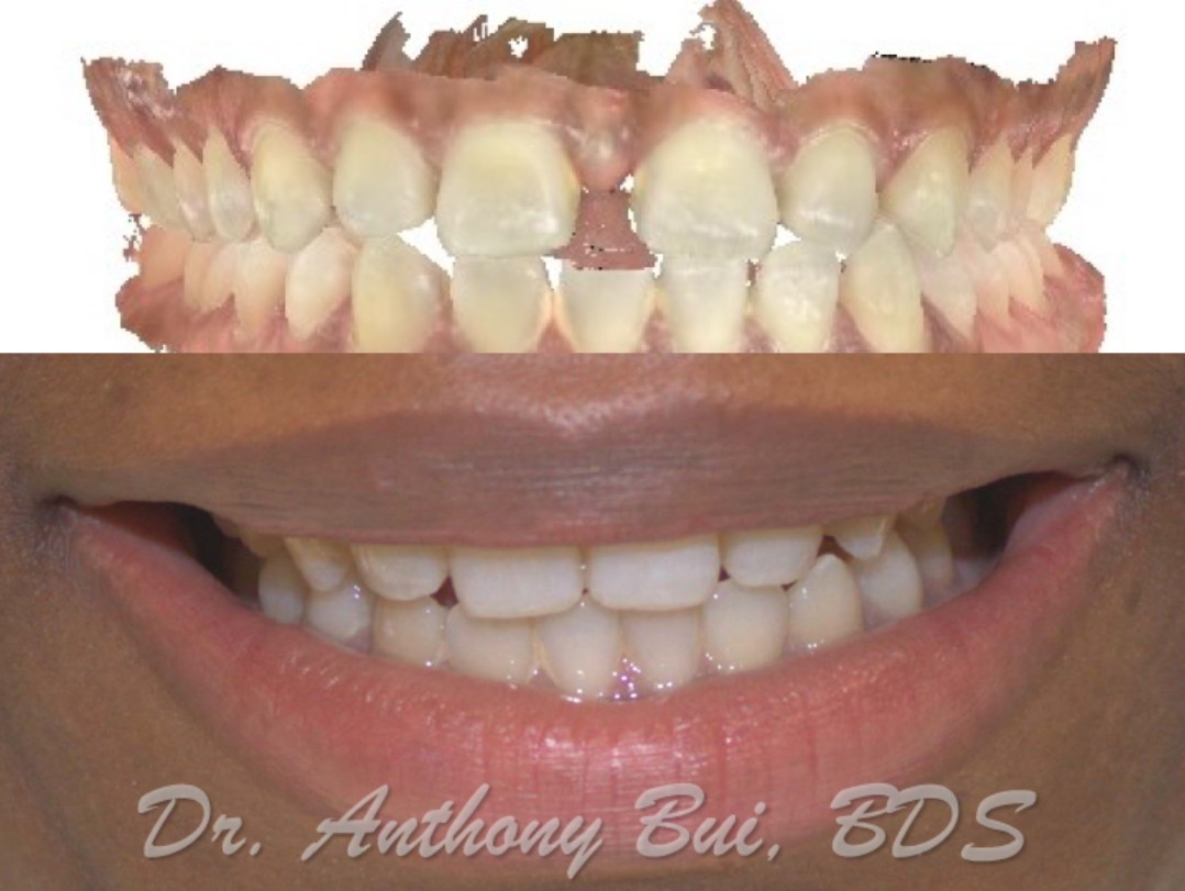 Smile Makeover Cleophat