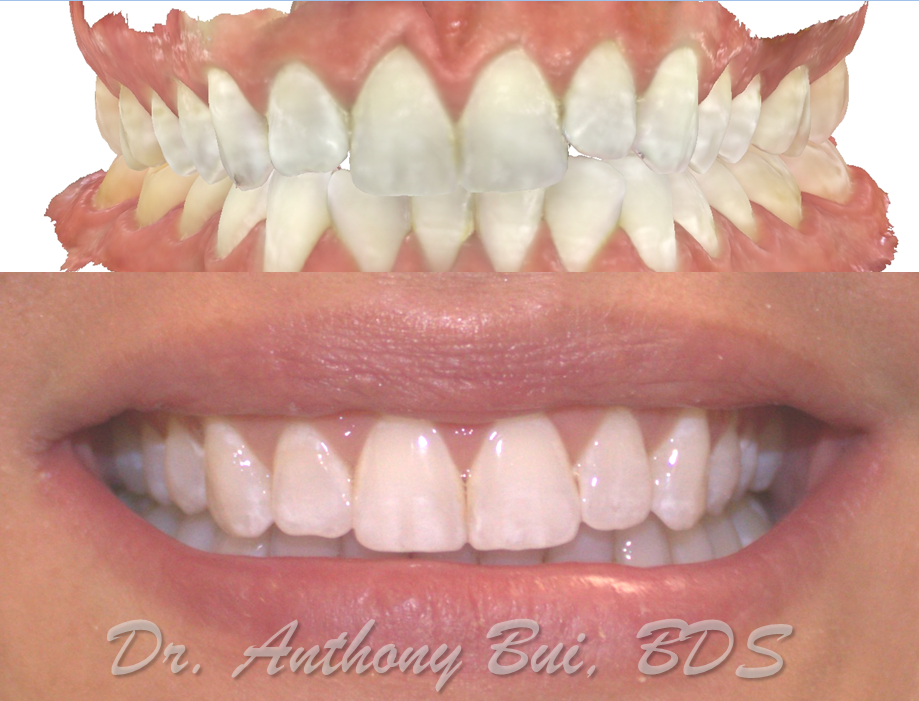 Smile Makeover McNaughton