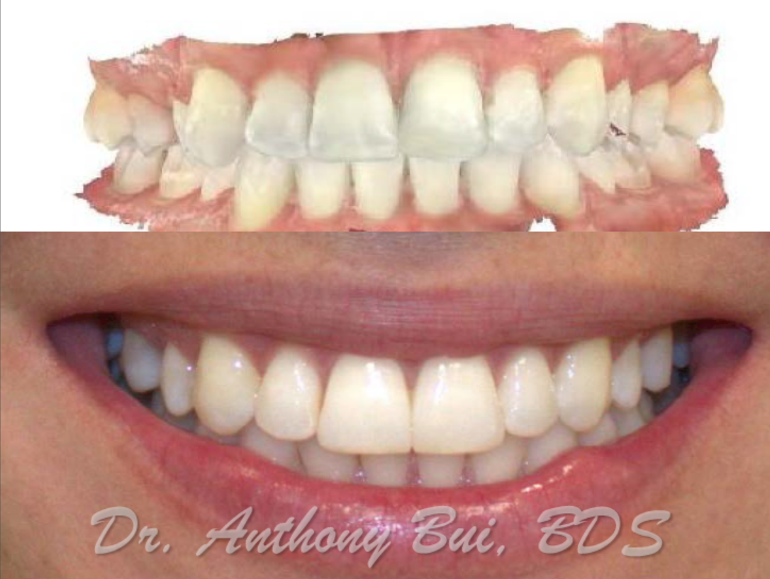 Smile Makeover Watson