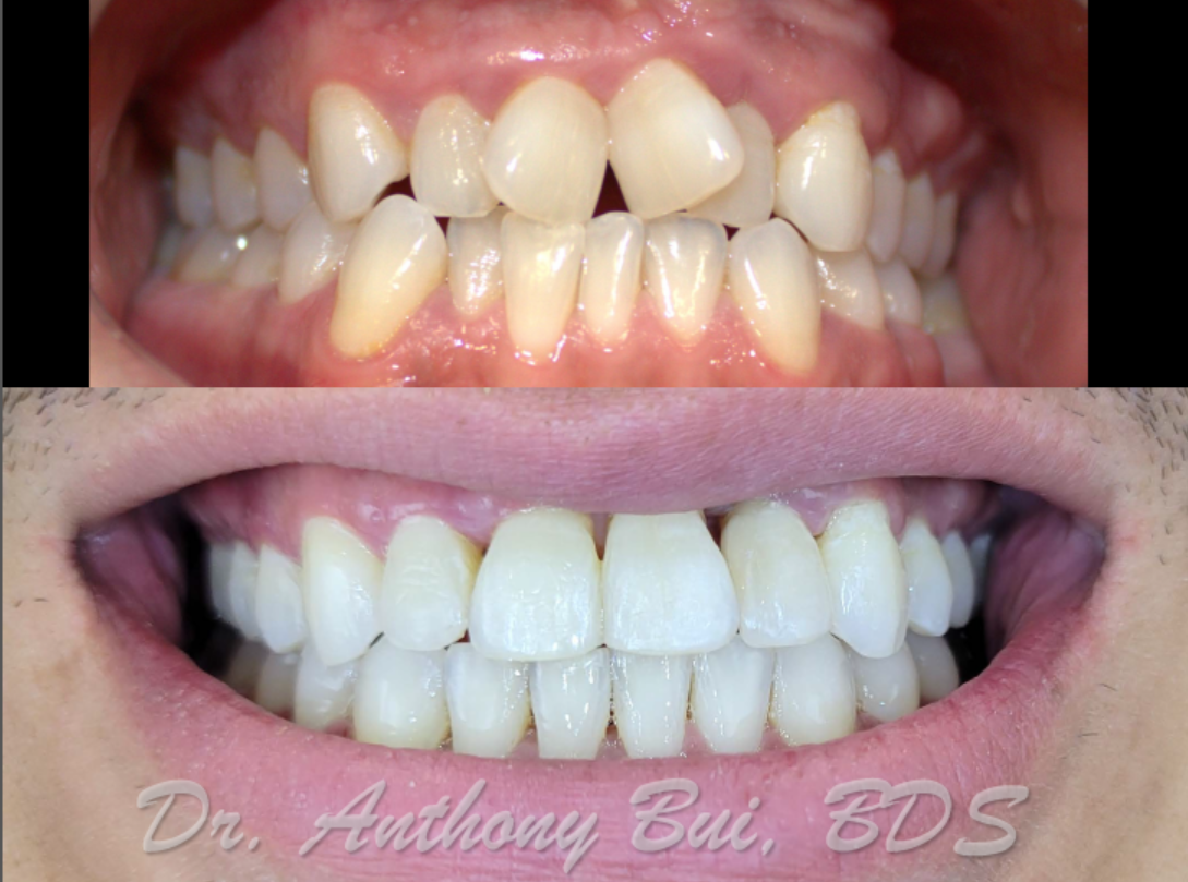 Smile Makeover Wiggins