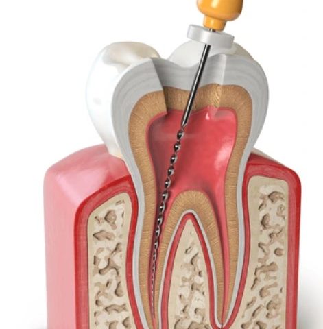 https://ottawadentalcare.ca/wp-content/uploads/2025/11/endodontics-logo-1-471x480.jpg
